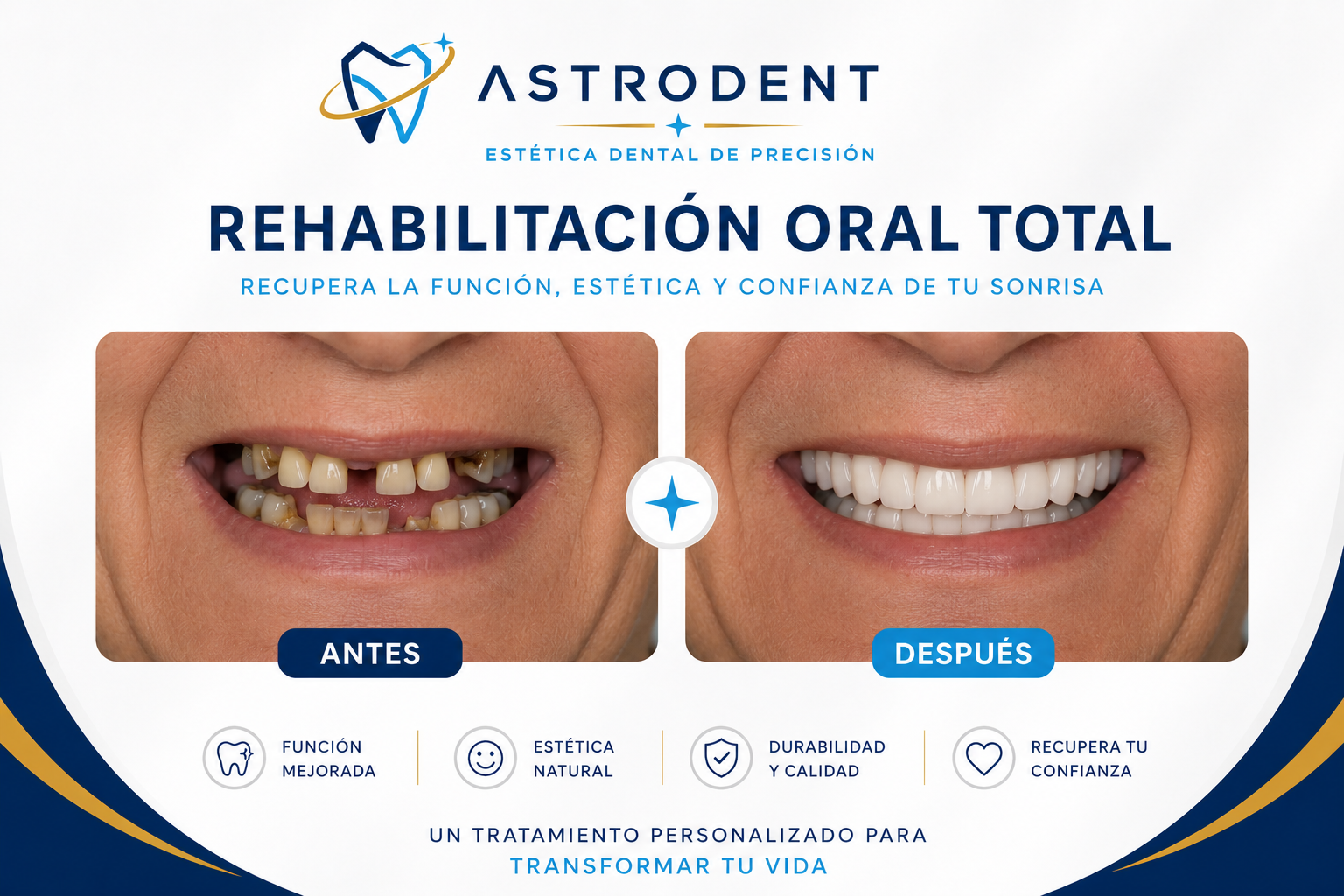 Resultado antes y después de rehabilitación oral total en ASTRODENT Bogotá