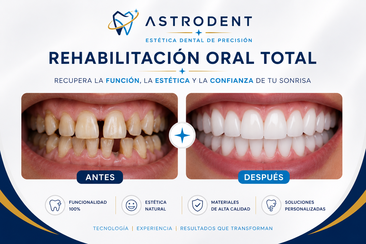 Rehabilitación oral completa con implantes dentales en Bogotá — ASTRODENT