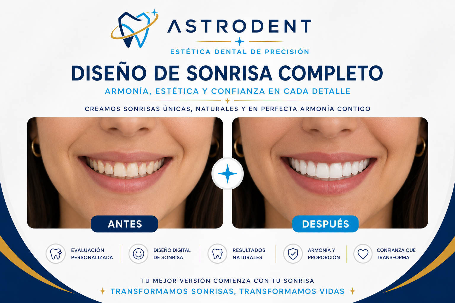 Transformación completa de sonrisa con diseño de sonrisa en Bogotá — ASTRODENT